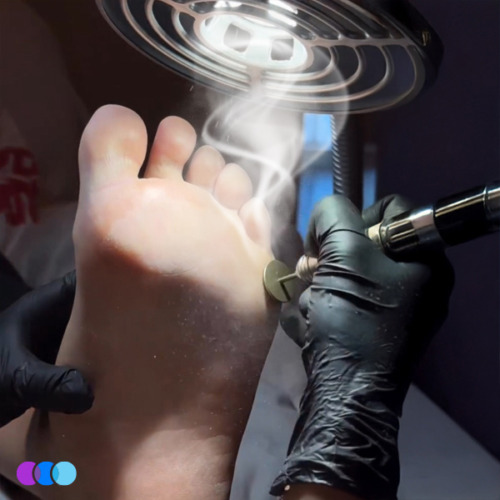aerovex-sunflower-ii-pedicure-action-2 A gloved hand uses an electric tool to file the bottom of a person’s foot under a vent with visible suction, removing dead skin. The foot is held steady, and the setting appears clinical. Three colored circles are seen at the bottom left corner. Read more at Aerovex Systems (aerovexsystems.com)